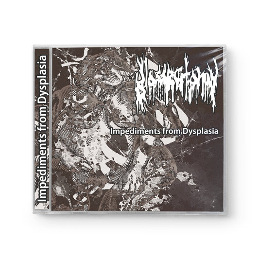 Glossectomy "Impediments From Dysplasia" CD
