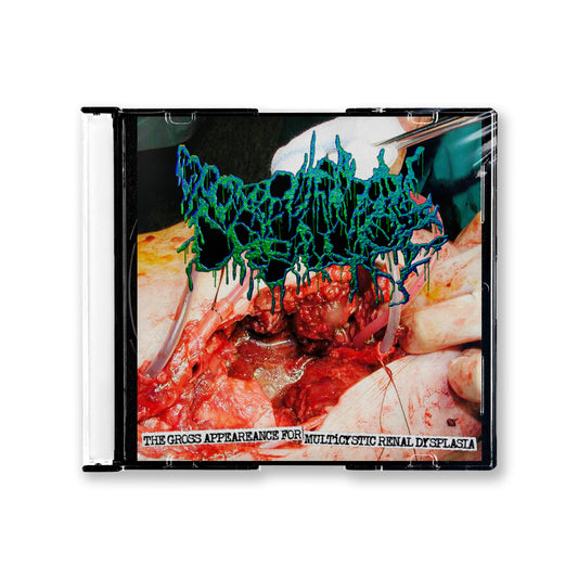 Excremental Carnage "The Gross Appeareance For Multicystic Renal Dysplasia" CD